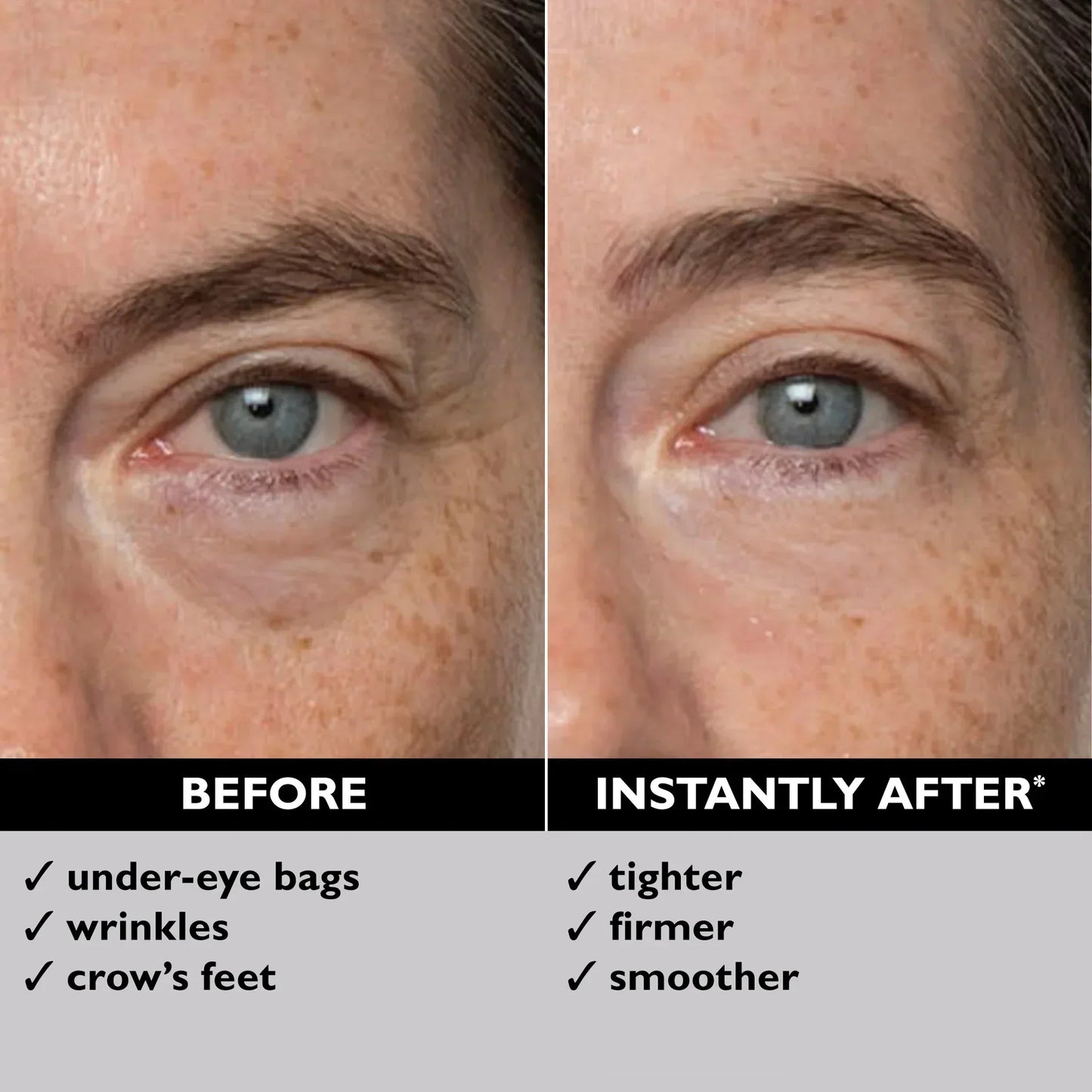 Eye Bag Instant Eraser, Tightens, Firms, & Blurs Wrinkles