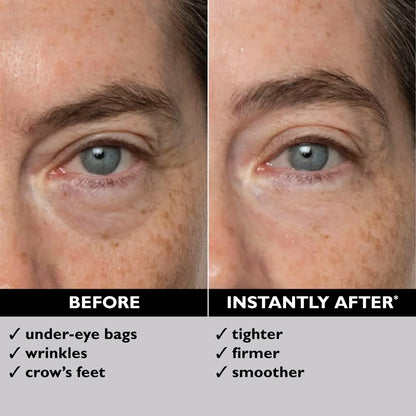Eye Bag Instant Eraser, Tightens, Firms, & Blurs Wrinkles