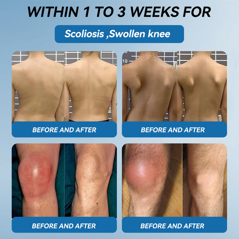 Juxek™ BPC-157 Joint Healing Cream 🦴Treats Arthritis, Neuropathy, Rheumatism, Sports Injuries & More👍